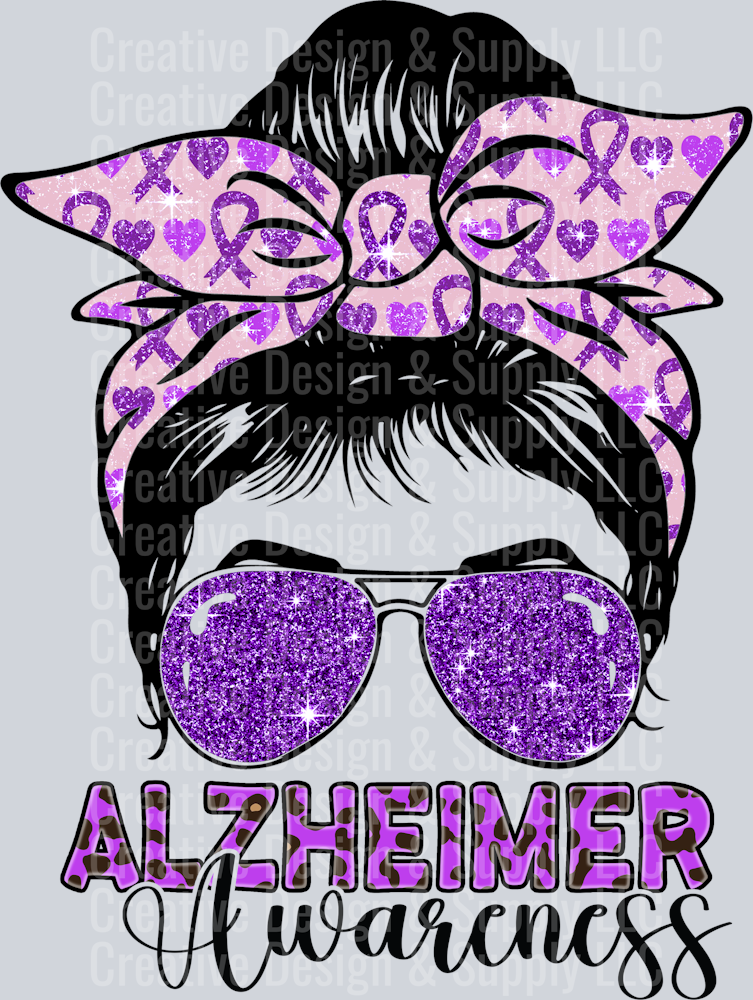 Alzheimers 2214
